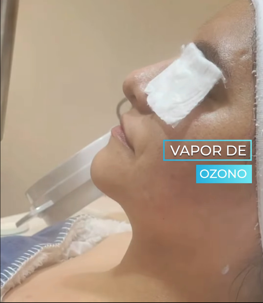 Tratamiento 3