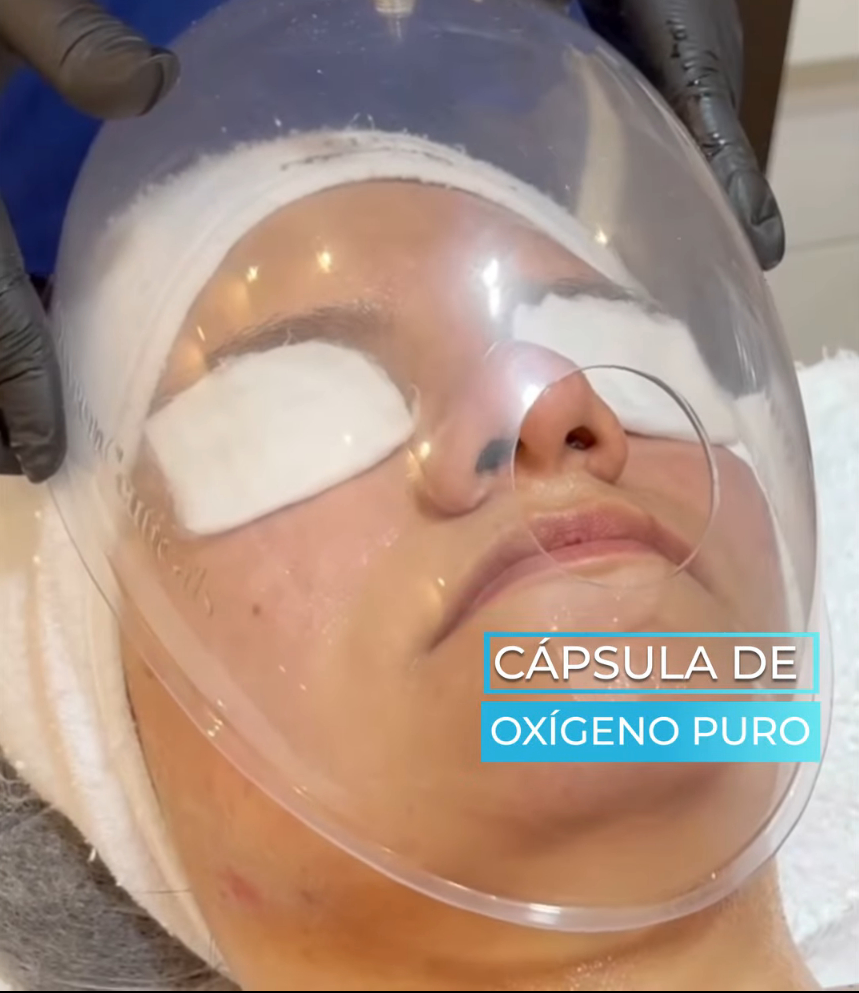 Tratamiento 7