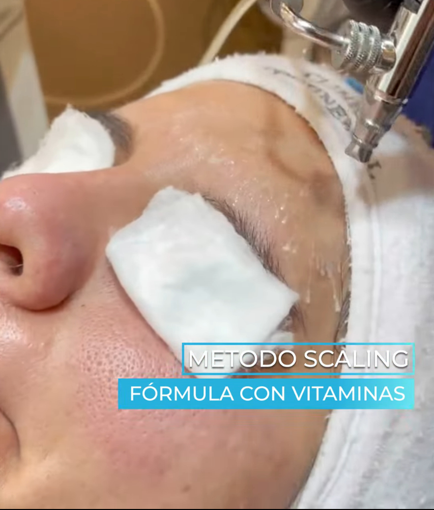 Tratamiento 6